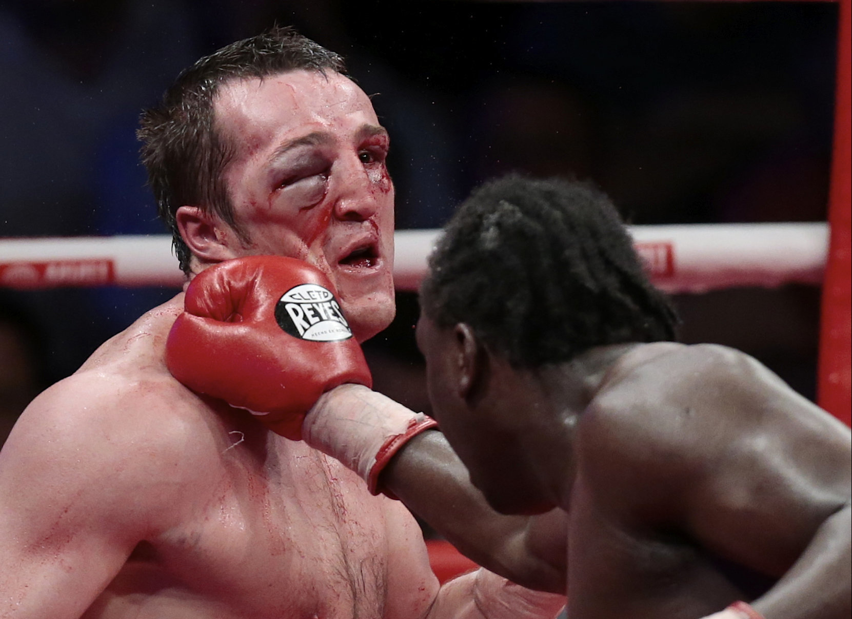 Denis Lebedev Eye Injury: Boxer's Face Extremely Swollen In Fight With ...