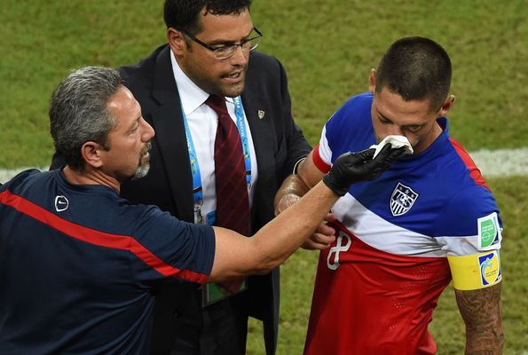 2014 World Cup: USA soccer team needs Clint Dempsey even with broken nose –  New York Daily News