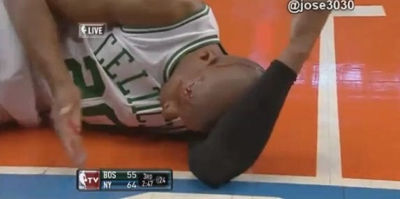 Ray Allen Bloodied After Elbow To Head During Celtics-Knicks Game ...