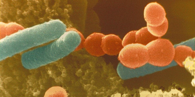 Color enhanced scanning electron micrograph (SEM) of Lactobacillus bulgaricus and Streptococcus thermophilus bacteria in yogurt. Yogurt is made in part through the fermenting action of these bacteria.