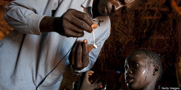 YIDA REFUGEE CAMP, SOUTH SUDAN - JULY 5: A girl with a high fever gets tested for malaria at the CARE medical clinic at the Yida refugee camp along the border with North Sudan July 5, 2012 in Yida, South Sudan. Yida refugee camp grows each day and now has swollen to 64,317, as the refugees continue to flee from South Kordofan in North Sudan. The numbers of refugees arriving from North Sudan vary from 500 to 1,000 a day. Many new arrivals have walked from 3 to 5 days to reach the camp, most without food. The rainy season has increased the numbers suffering from diarrhea, severe malnutrition and malaria with sanitation issues causing the increased illness. Field hospitals say that 95% of all patients are under the age of five. (Photo by Paula Bronstein/Getty Images)