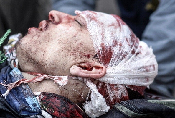 <br>A heavily injured anti-government protestor is carried by fellow demonstrators during clashes with riot police in central