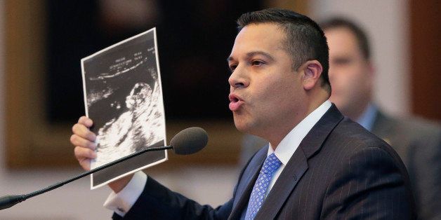 CORRECTS THAT BILL WAS PROVISIONALLY PASSED TUESDAY WITH FINAL VOTE ON WEDNESDAY - Rep. Jason Villalba, R-Dallas, holds a sonogram showing his unborn son during final remarks before a provisonal vote on HB 2, an abortion bill,Tuesday, July 9, 2013, in Austin, Texas. A final, formal vote is scheduled for Wednesday. The bill, which passed, would require doctors to have admitting privileges at nearby hospitals, only allow abortions in surgical centers, dictate when abortion pills are taken and ban abortions after 20 weeks. (AP Photo/Eric Gay)