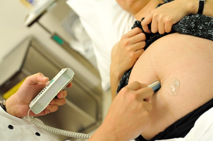 A midwife uses a doppler device to listen to a baby's heartbeat 