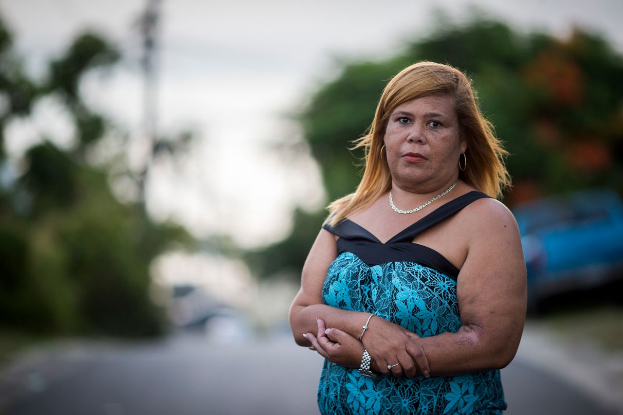 Rivera Acosta stands outside of her home in Vieques. The mother of two said the long journey to the main island for treatment prevents her from taking care of her children. 