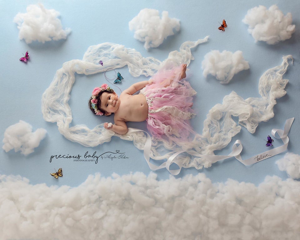 Whimsical Photo Series Showcases Babies With Special Needs Huffpost Life