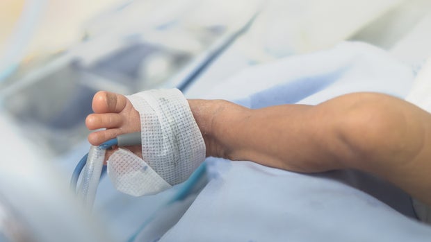 Newborn leg in incubator with medical monitor equipment for treatment of preterm infant