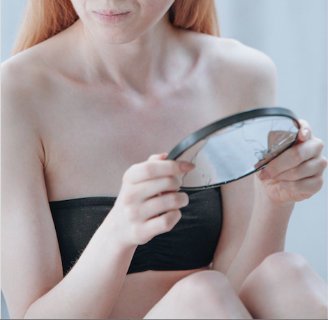 Body dysmorphic disorder, an excessive preoccupation with appearance, has a lot in common with eating disorders but should not be confused with them.