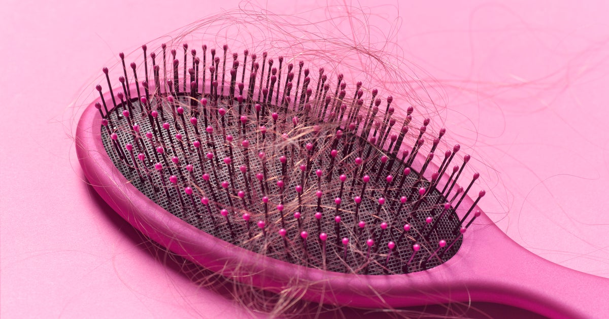 Why Is My Hair Falling Out? Causes And Treatment For Female Hair Loss