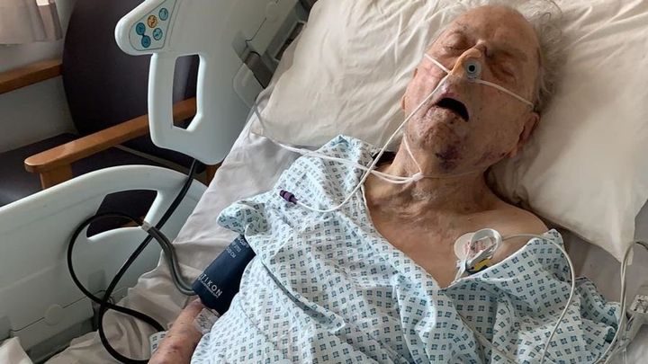The family of Peter Gouldstone, pictured, have shared a shocking image of the 98-year-old in hospital after a violent attack at his home.