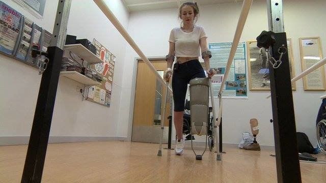 Victoria Lebrec having rehabilitation and learning to walk again after losing her leg.