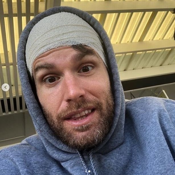 Joel Dommett posted a video on him with a bandage on his head on Instagram Stories