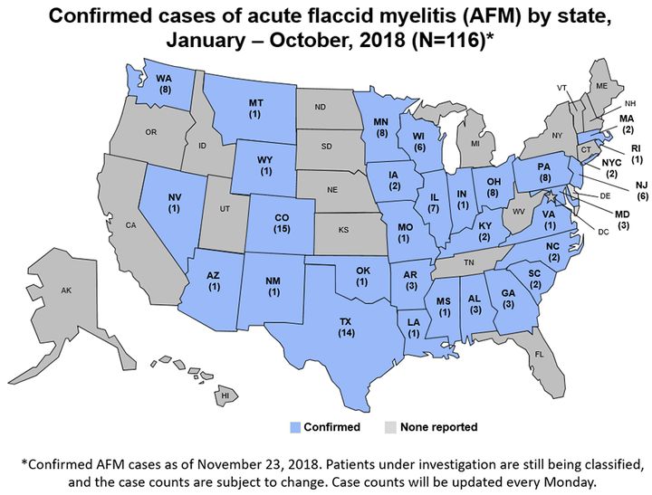 There are 116 confirmed cases of acute flaccid myelitis in 31 states, the CDC said.