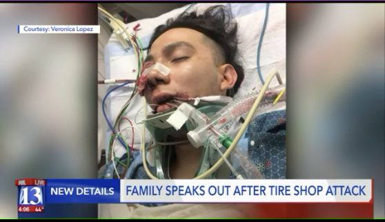 Luis Gustavo Lopez, an 18-year-old student at Salt Lake Community College, got a shattered cheekbone and eye socket in the attack