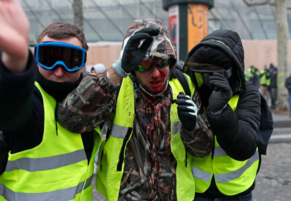 A demonstrator wearing a yellow vest is covered in blood after getting in injured during a protest in Paris.