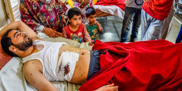 A Kashmiri Muslim man lies wounded on a hospital bed after government forces fired pellets on September 11, 2016 in Srinagar.