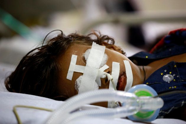 A child is seen in the Intensive care unit in the Baba Raghav Das hospital in Gorakhpur district, India August 13, 2017.