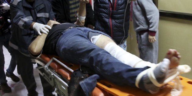 AP cameraman who shot in leg while covering Gaza protests