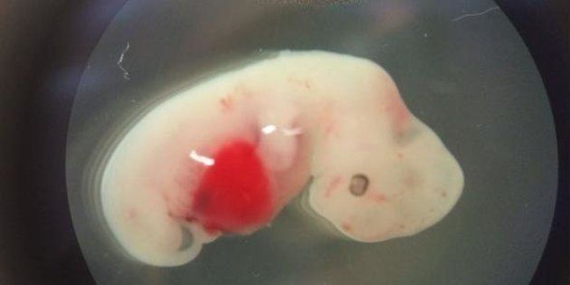 This pig embryo was injected with human stem cells and grew to be four weeks old before it was destroyed