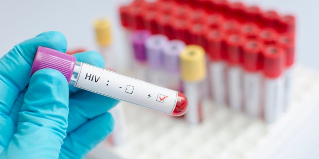 Treatment that would suppress HIV levels without the need for antiretroviral therapy would be considered a “functional” cure.