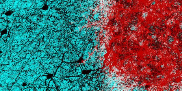 Embryonic neurons (shown in red) transplanted into the adult mouse brain connect with host neurons (shown in black), rebuilding neural circuits previously lost due to an injury.