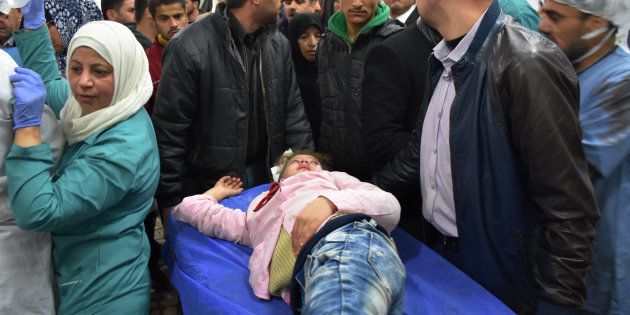 An injured Syrian girl lies on a stretcher at a hospital in the government-held side of west Aleppo, on November 20, 2016, following reported rocket fire by the opposition forces that hold the eastern part of the city.At least seven children were killed by rebel rocket fire that hit a school in the government-held west of Aleppo city, state media said. Government forces are currently waging a ferocious assault against east Aleppo, targeting it with air strikes, barrel bombs and artillery fire. / AFP / GEORGE OURFALIAN (Photo credit should read GEORGE OURFALIAN/AFP/Getty Images)