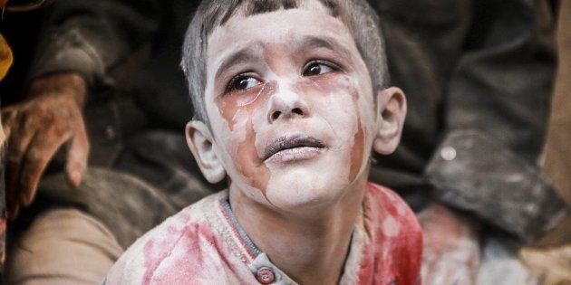 ALEPPO, SYRIA - OCTOBER 11: A wounded Syrian kid cries after the war-crafts belonging to the Russian army bombed the opposition controlled Firdevs neighborhood in Aleppo, Syria on October 11, 2016. (Photo by Jawad al Rifai/Anadolu Agency/Getty Images)
