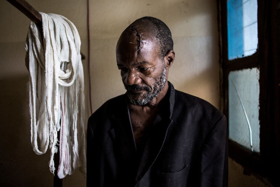 Ο Μπαουμά Γιοαμέ, 56 ετών, αναρρώνει σε θάλαμο νοσοκομείου στο Μπούνια. Τραυματίστηκε σοβαρά με πολλαπλά κοψίματα στο κεφάλι όταν το χωριό του δέχτηκε επίθεση. (Μάρτιος 2018)