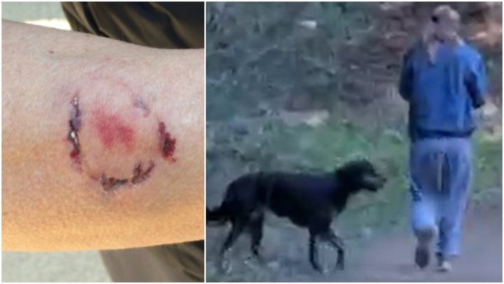 Local police posted photos to Facebook showing a woman who is now facing charges for allegedly attacking and biting a female