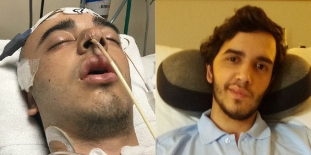 dano nervoso após cirurgia