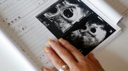 Como é receber a conta a pagar por sofrer um aborto