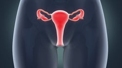 Estes são os motivos que levam as mulheres a congelar os