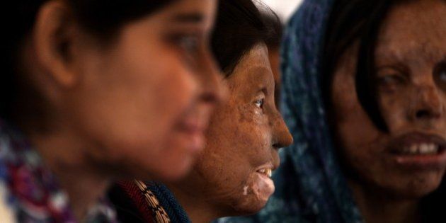 Indian acid attack survivors looks on as they mark the beginning of a hunger strike in New Delhi on December 12, 2014. Activists from Stop Acid Attacks launched the 'Hunger Strike of Acid Attack Fighters' campaign to highlight the rights of survivors of acid attacks and including a call for the ban of the sale of over-the-counter acid. AFP PHOTO / CHANDAN KHANNA (Photo credit should read Chandan Khanna/AFP/Getty Images)