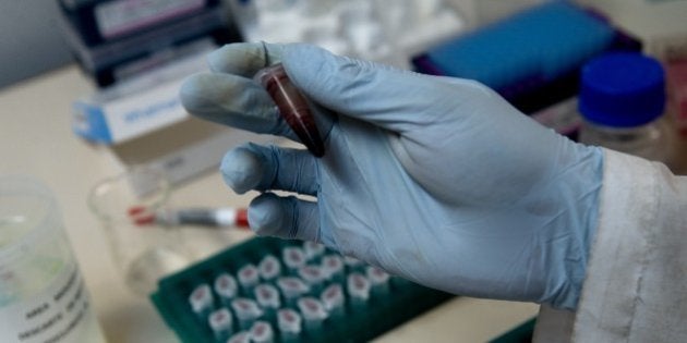 A scientist holds a blood sample in a laboratory at the Center for Scientific Research Caucaseco in the outskirts of Cali, Colombia, on April 25, 2012, during the World Day for the fight against malaria. After Colombian physician Manuel Elkin Patarroyo developed a vaccine against malaria in 1986, Colombian scientists keep researching for another immunization for the illness, which in 2010 caused over 855.000 deaths all over the world. A team of 40 scientists is preparing to begin the second phase of chemical tests for a synthetic vaccine against malaria. Malaria is caused by the Plasmodium vivax and Plasmodium falcitarum parasites, and is transmitted by mosquitoes. AFP PHOTO/Luis ROBAYO (Photo credit should read LUIS ROBAYO/AFP/GettyImages)