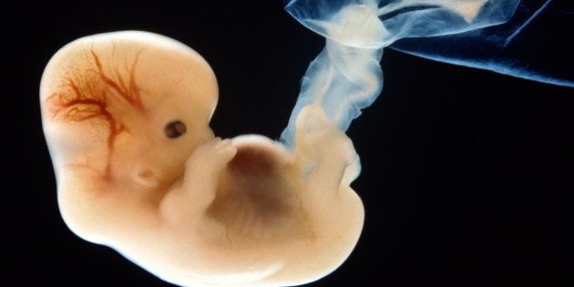 The term embryo defines an unborn offspring from the moment of fertilization up to the eighth week of development. During this time all the main organs are formed.From eight weeks onwards the unborn offspring is referred to as a foetus.