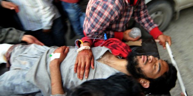 A Kashmiri youth is stretchered into a hospital in Srinagar on April 15, 2016, after sustaining injury in an alleged firing incident by security forces in Kupwara District of the restive Himalayan state.A teenager was killed in Indian-administered Kashmir when soldiers fired on protesters, taking the death toll to five in clashes that have continued for the fourth consecutive day, officials said. / AFP / STR (Photo credit should read STR/AFP/Getty Images)