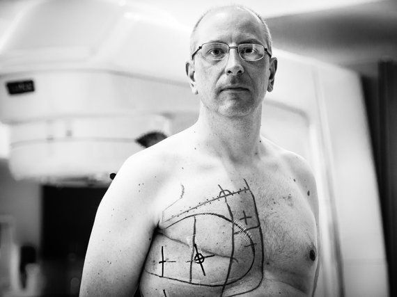 Breast Cancer Can Happen To Men Too | HuffPost News