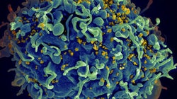 Nova vacina de HIV promete barrar todas os tipos do