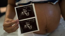 Mulheres pobres são o elo frágil da epidemia mundial de