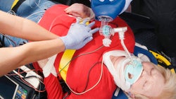 5 segredos sobre reanimação cardiorrespiratória (que os médicos querem que você