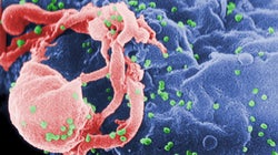 Ele inventou o exame de HIV. Agora, pesquisa vacina para derrotar o