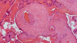 A placenta geralmente não recebe o reconhecimento que