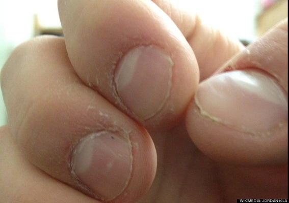 完璧主義者は爪を噛む 研究結果 ハフポスト News 完璧主義者は爪を噛む 研究結果 ハフポスト News