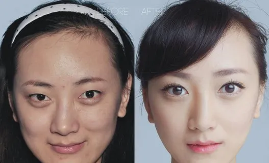 アジア人女性たちの 美容整形通い は止まらない 画像 ハフポスト Life