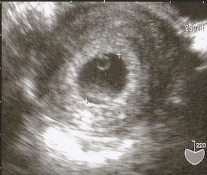 身長100cmの私が過ごした妊婦生活は 女性として とても居心地がいいものでした ハフポスト 身長100cmの私が過ごした妊婦生活は 女性として とても居心地がいいものでした ハフポスト