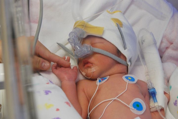 赤ちゃんは呼吸が安定していなかったので、保育器の酸素濃度を高くし、また鼻に管を通し、酸素注入をしました。