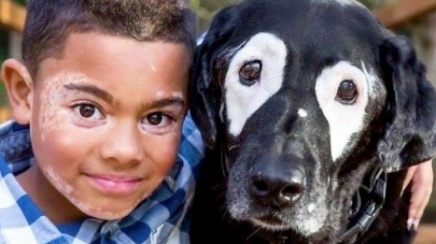 白斑の少年 同じ症状を持つ犬と出会う 初めて会った瞬間から 本物の家族のようだった ハフポスト Life