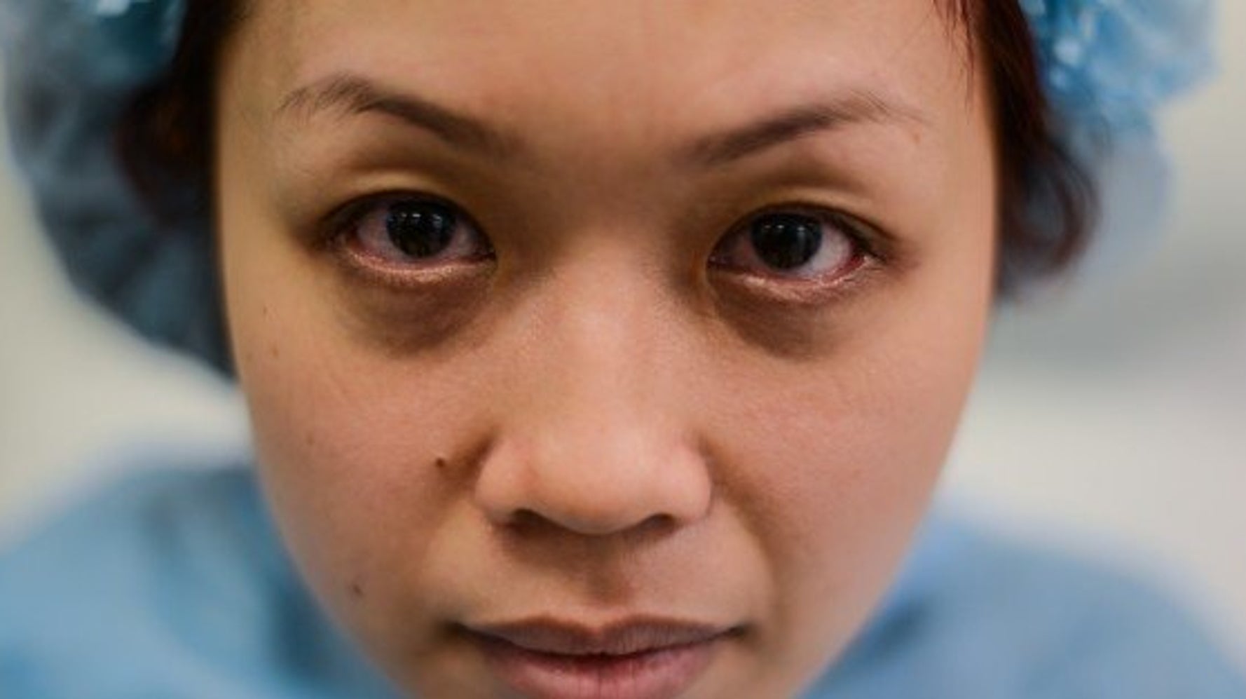 目の下のクマの原因は ハフポスト News