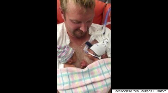 未熟児の双子の赤ちゃん お手々つないでパパの胸でスヤスヤ眠る 動画 ハフポスト Life