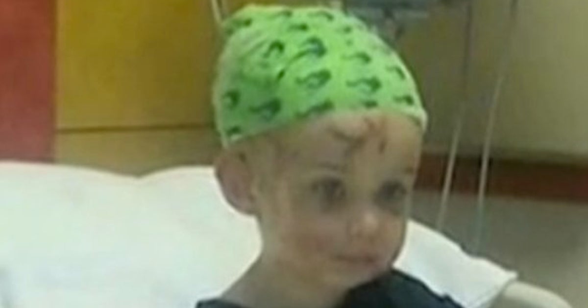 母親 猛犬の耳を噛みちぎって娘を救う 動画 ハフポスト